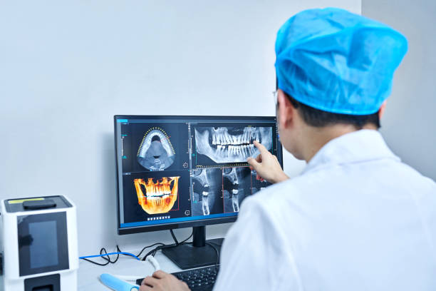 Best Emergency Wisdom Teeth Removal in Nokomis, IL